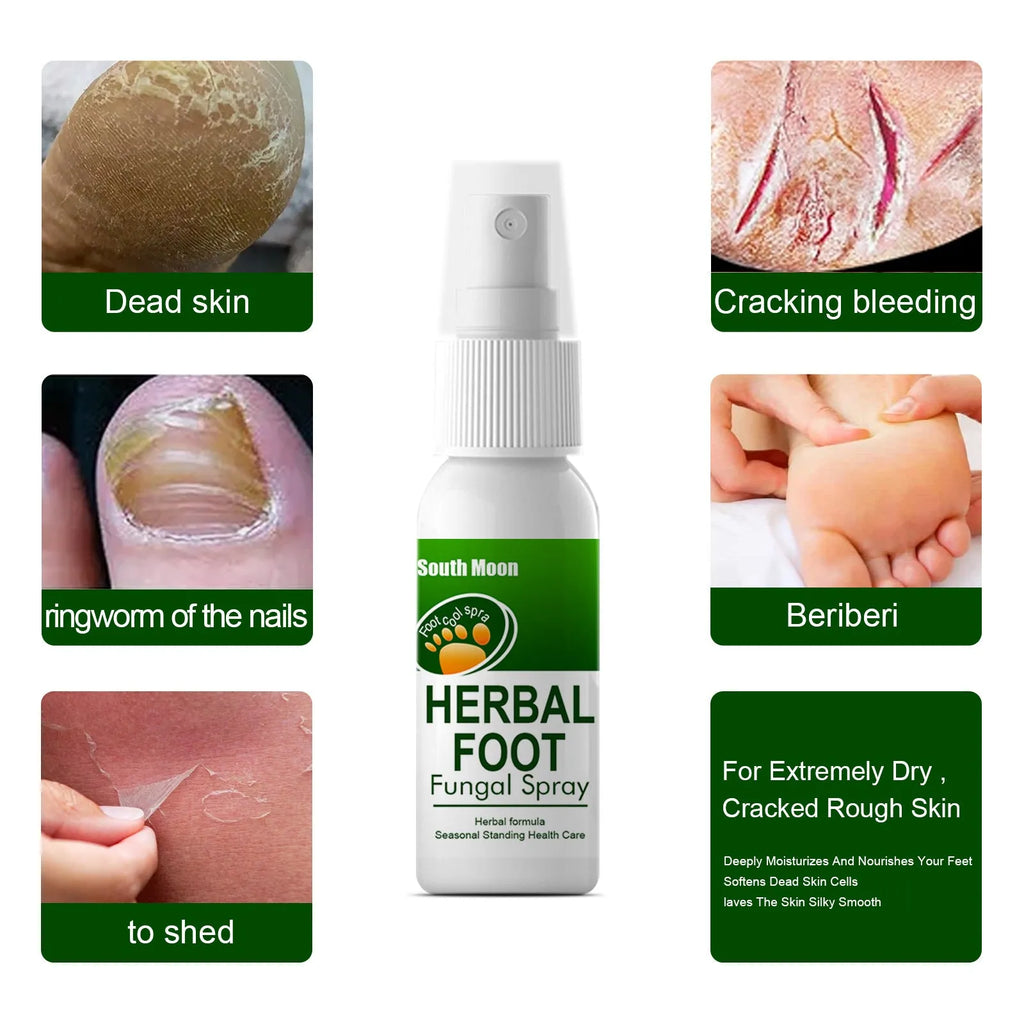 Foot Skin Nourishing Hydrating Care Spray 30ml bottle with spray nozzle on a white background