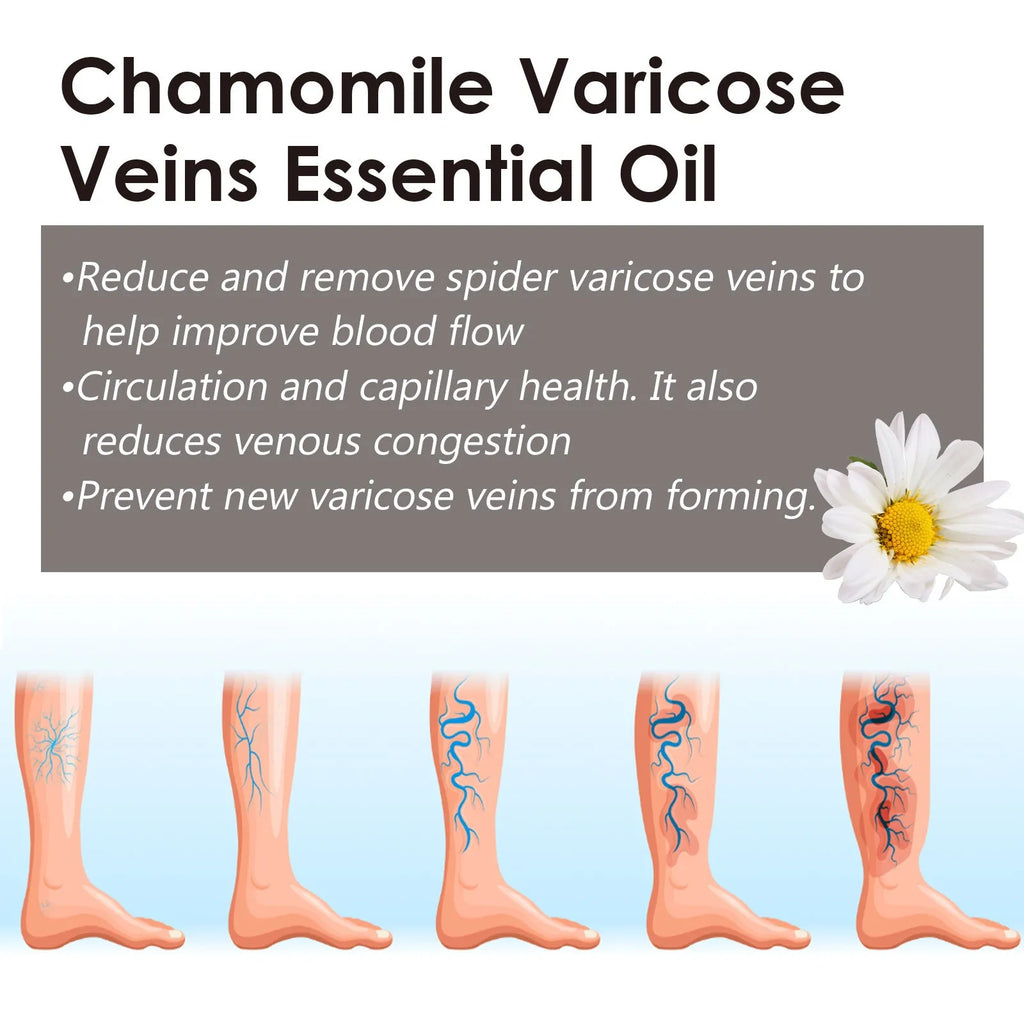 10ml bottle of chamomile leg essential oil for skin care and massage