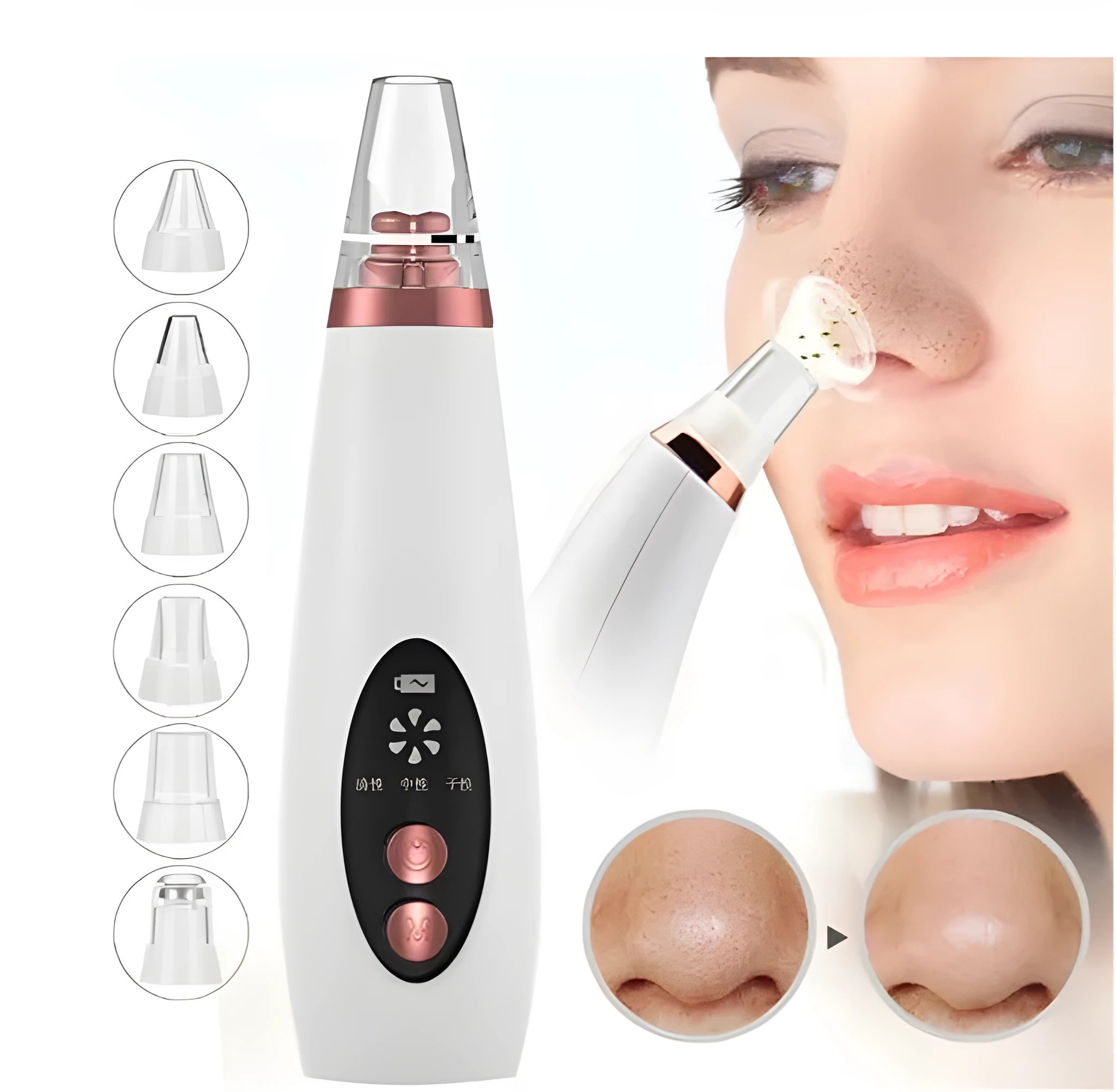 Microcrystalline blackhead remover model LY-9128 with USB charging and black suction nozzle