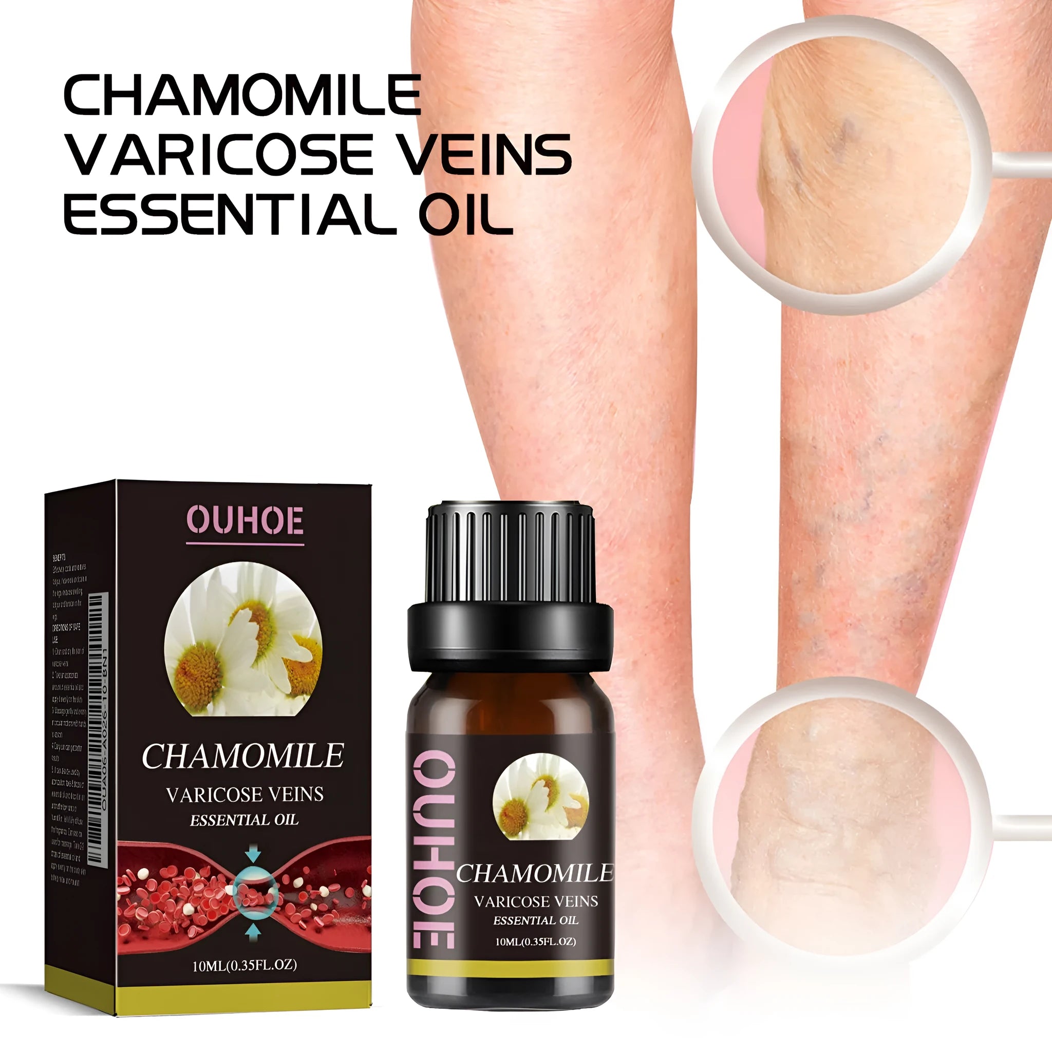 10ml bottle of chamomile leg essential oil for skin care and massage