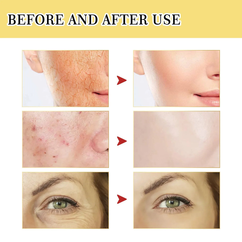 Snail Serum Collagen Facial Serum Original 100ml Hydrating Brightening Nourishing Firming Softening Skin Care Moisturising Treatment for Face