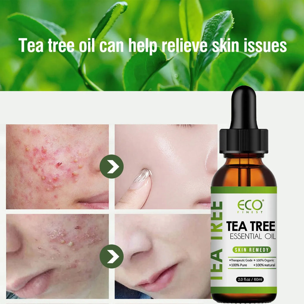 60ml tea tree oil massage oil bottle for acne fade spot treatment natural skincare