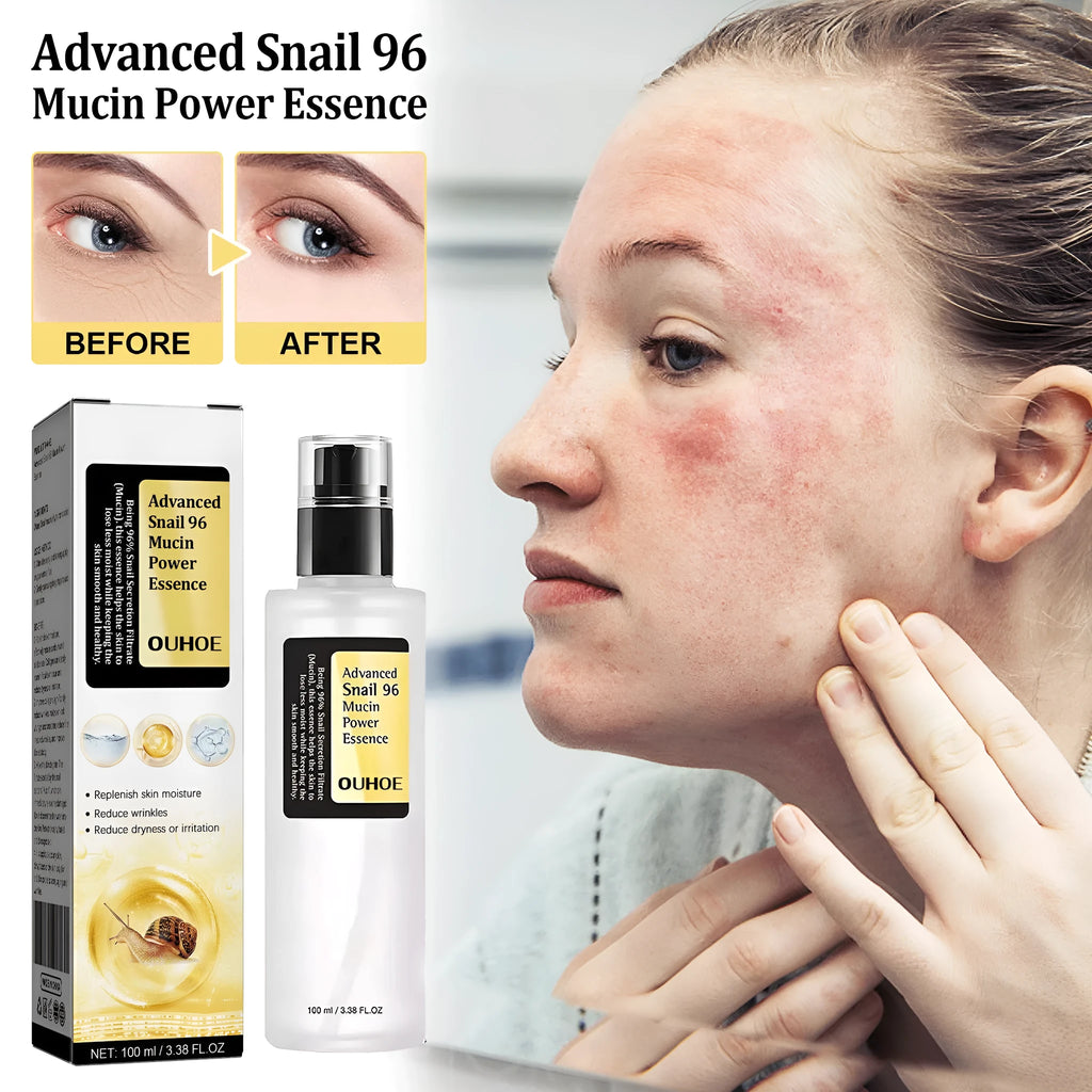 Snail Serum Collagen Facial Serum Original 100ml Hydrating Brightening Nourishing Firming Softening Skin Care Moisturising Treatment for Face