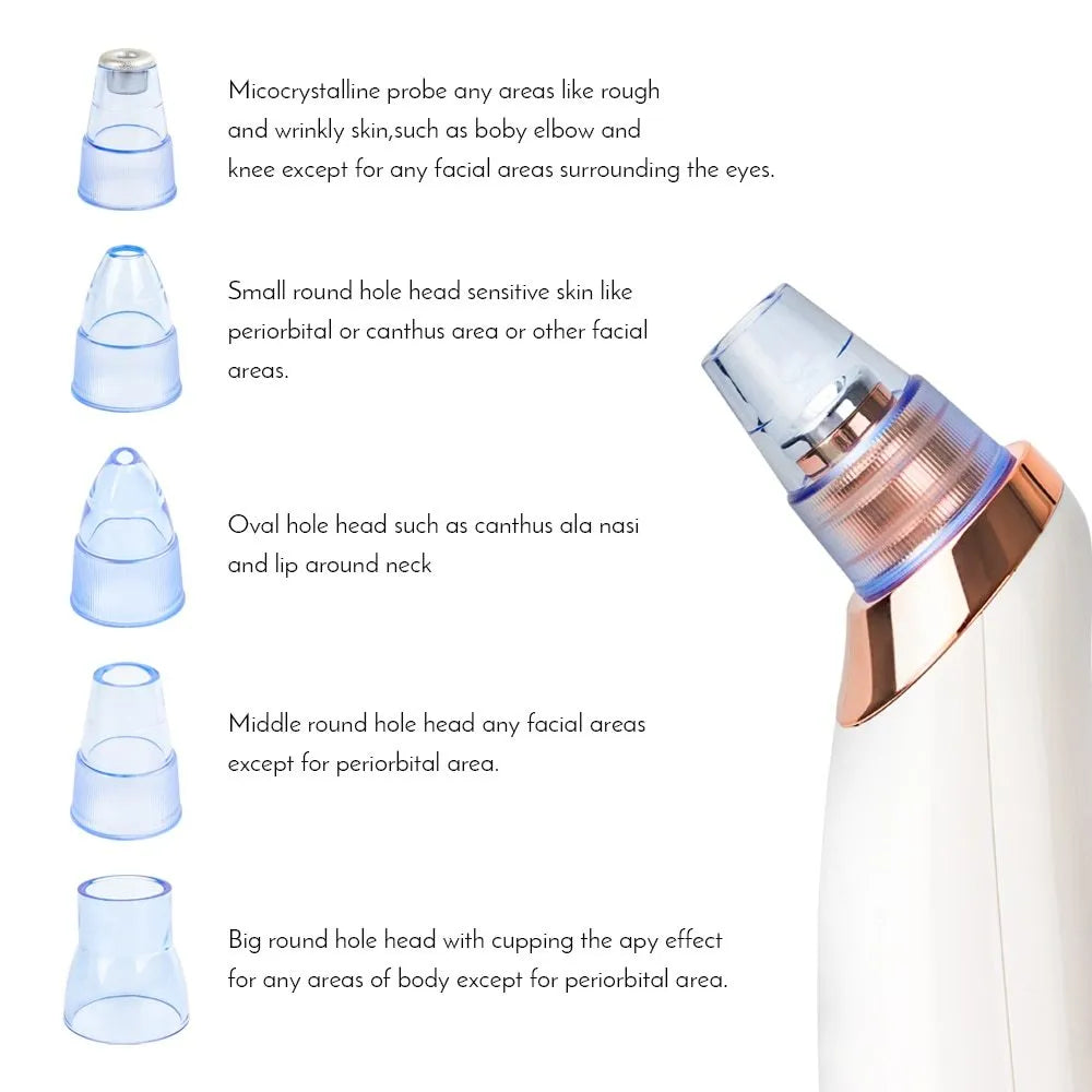 Electric blackhead remover device with multiple nozzle attachments for pore cleaning