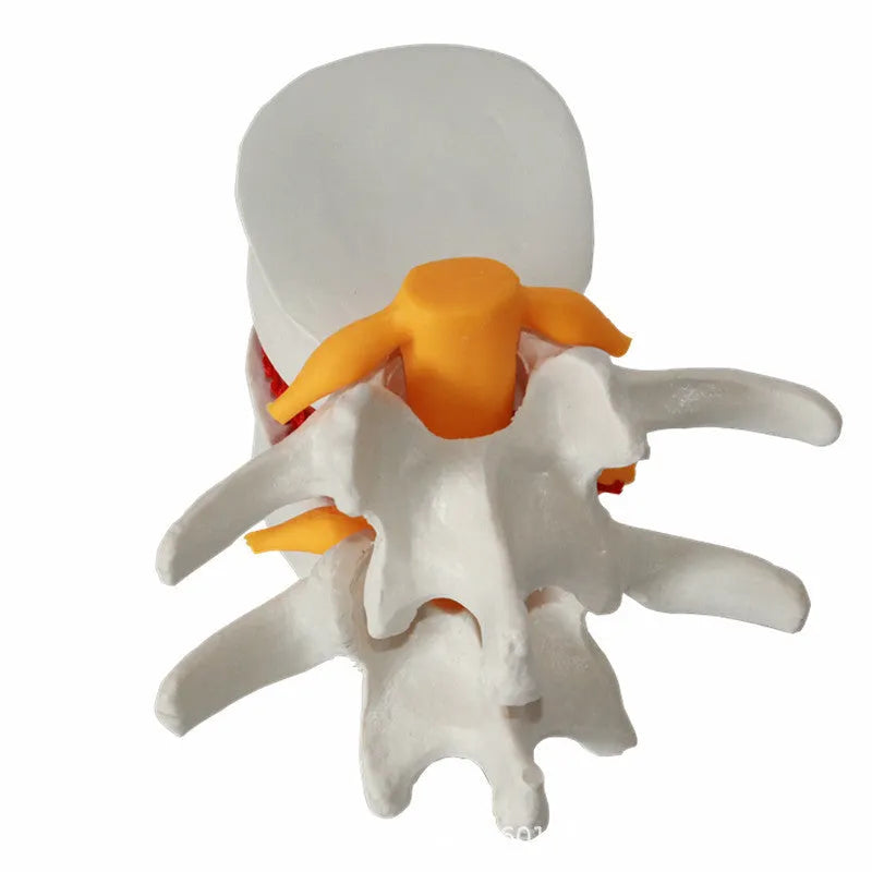 White PVC intervertebral disc herniation demonstration model for medical education