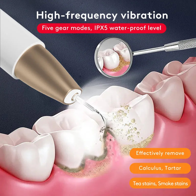 Gold-coloured ultrasonic tooth cleaning device for removing tartar and stains