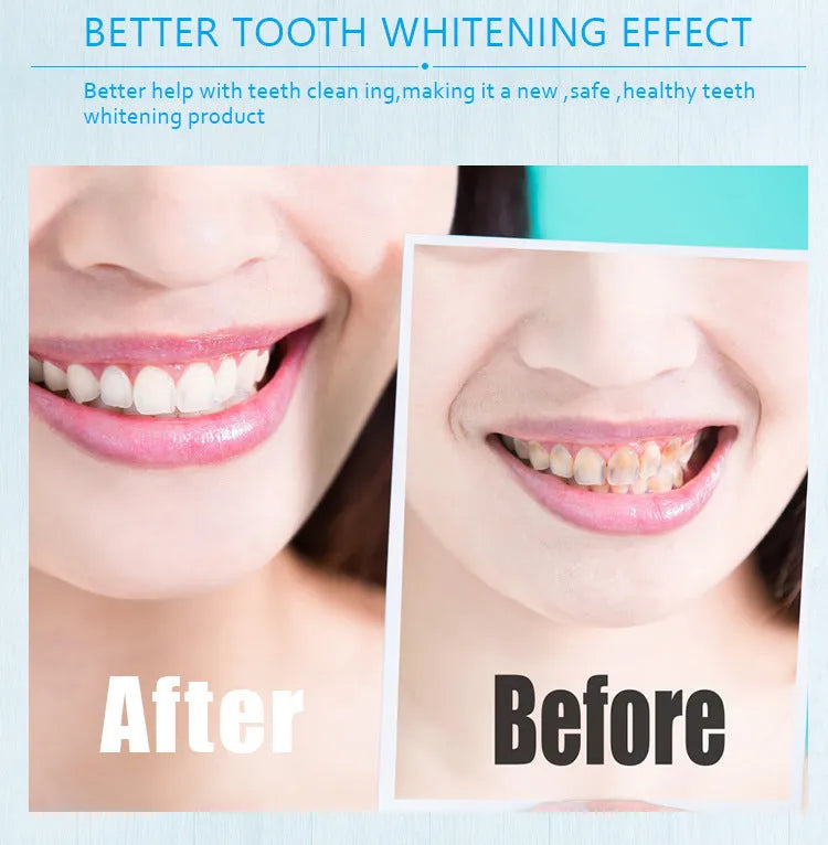 Teeth whitening pen with toothbrush cleaner gel in aluminium case, multi-colour options, adult use