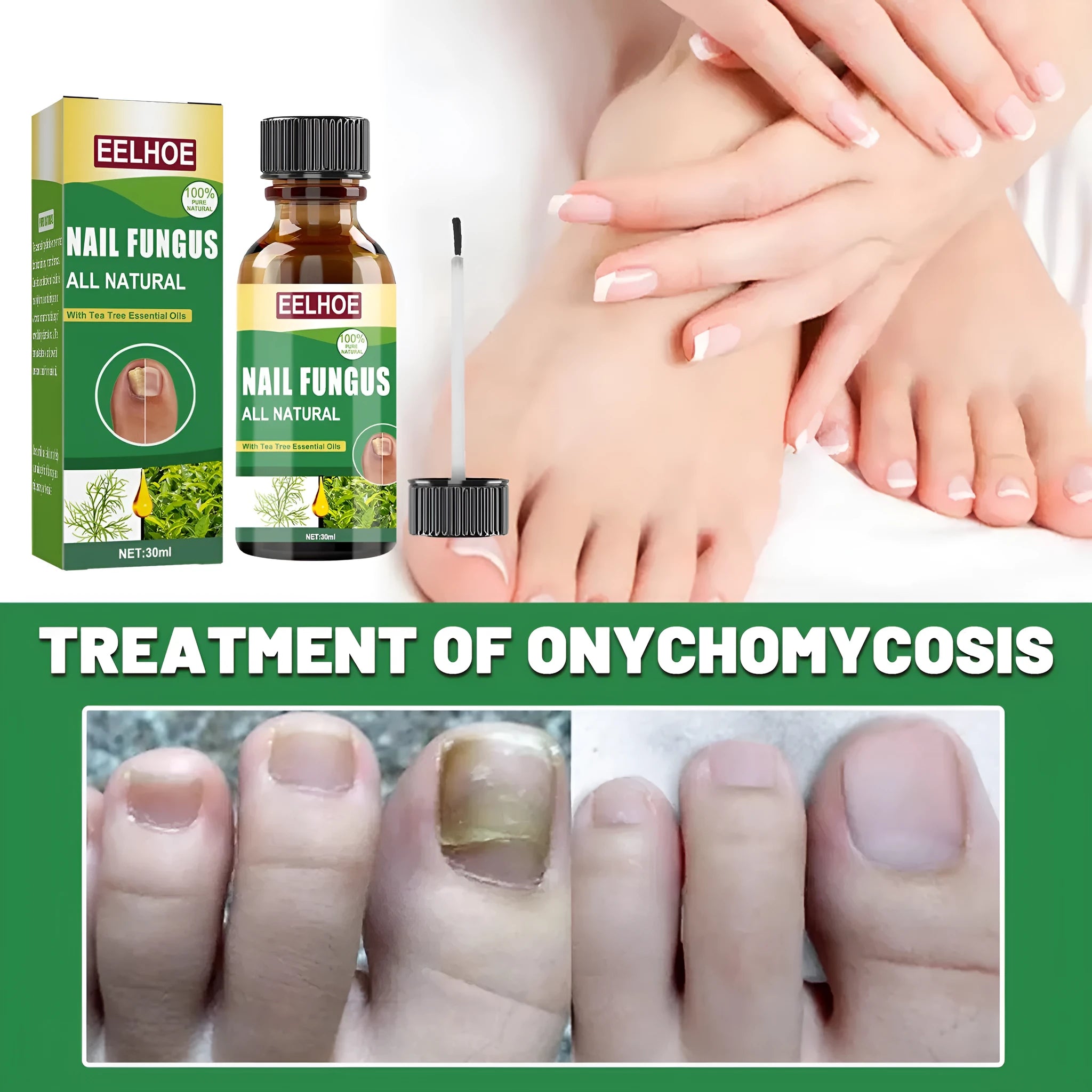 30ml bottle of tea tree oil foot and nail care repair liquid for thick soft nails