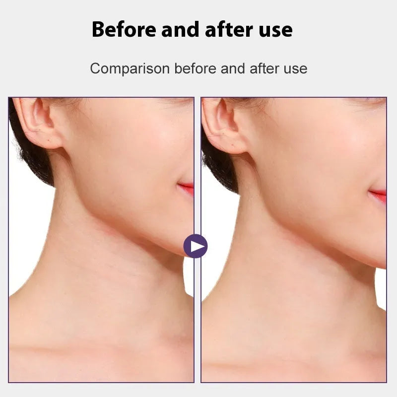 V27 skin tone neck pattern lifting sling with 20 firming adhesive patches on white background