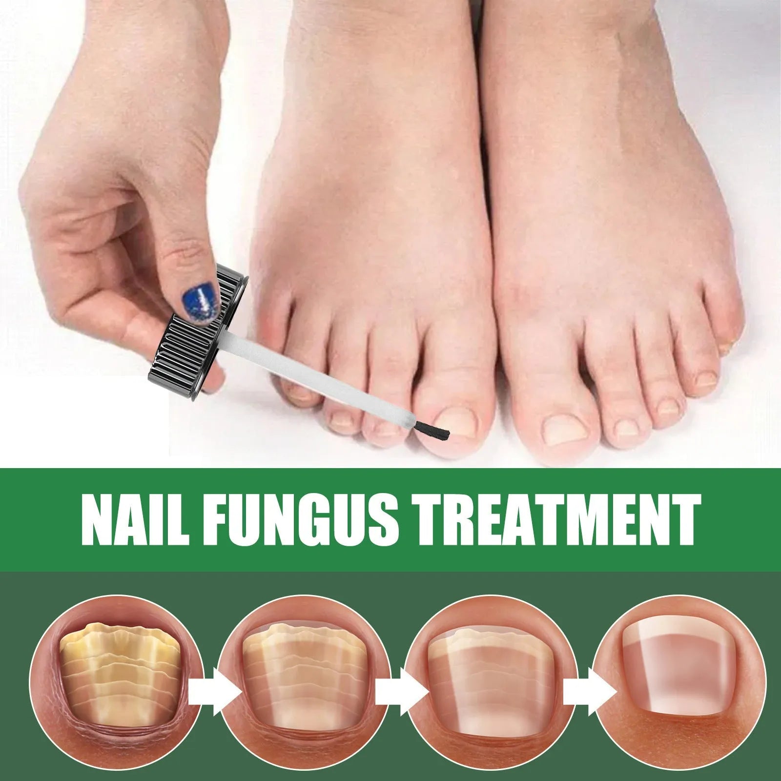 30ml bottle of tea tree oil foot and nail care repair liquid for thick soft nails
