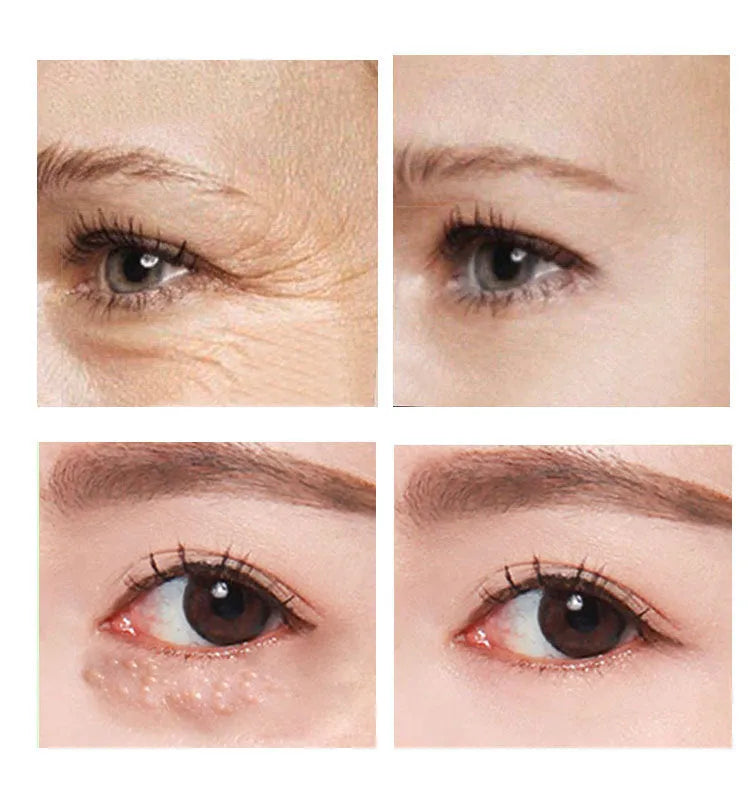 Jar of 30ml women's eye cream for skincare