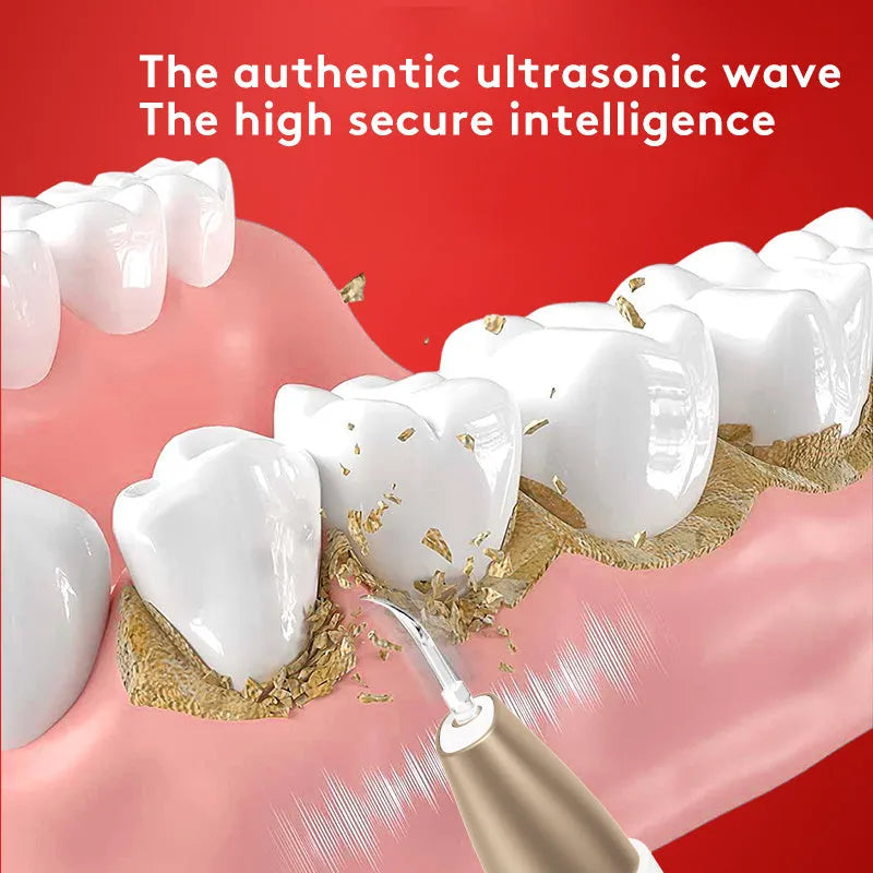 Gold-coloured ultrasonic tooth cleaning device for removing tartar and stains
